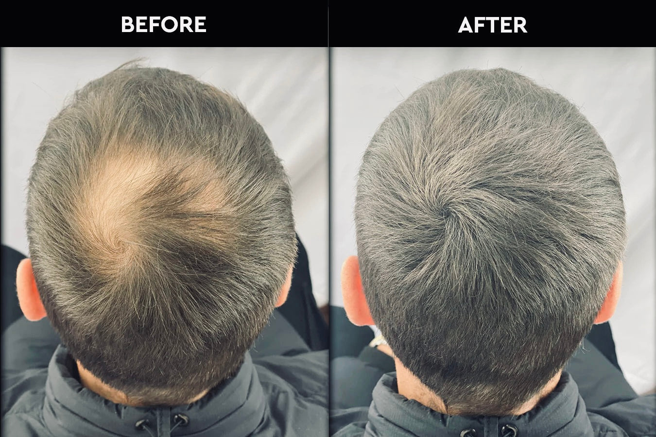 RootRevive™ Hair Fiber