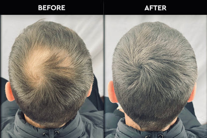 RootRevive™ Hair Fiber