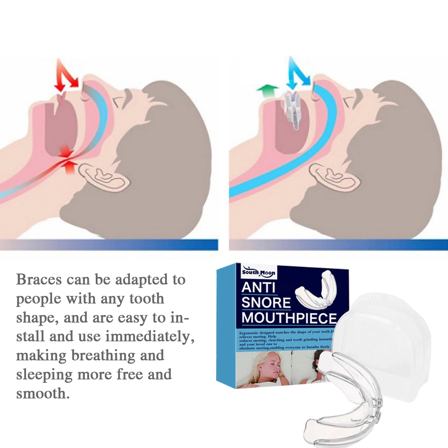 Adjustable Anti Snoring Mouthpiece for Sleeping Stop Snoring Prevent Apnea Anti Bruxism Mouth Guard Improve Sleep Aid Device