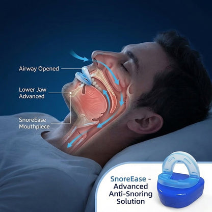 SnoreEase™ Mouth Guard