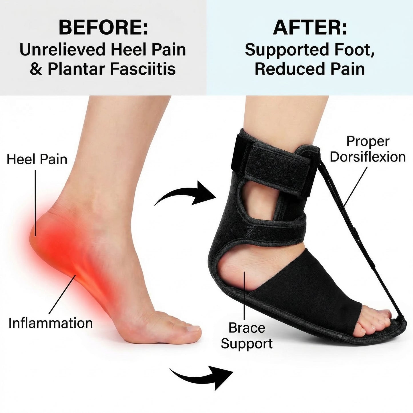 OrthoFlex™ Plantar Fasciitis Night Splint