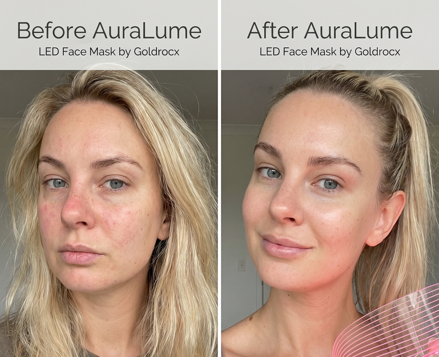 Auralume™ Skin Therapy Mask