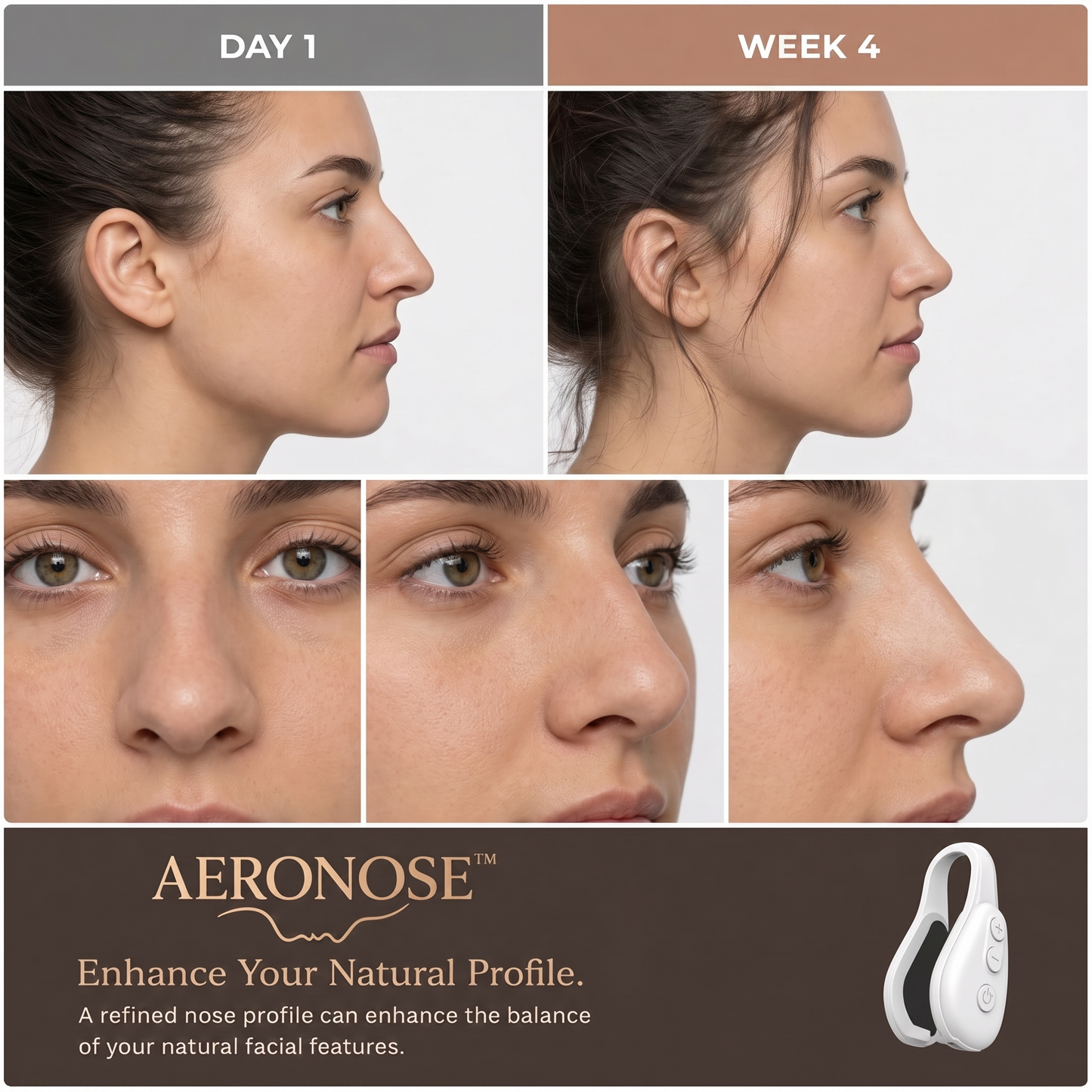 AERONOSE
